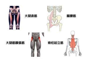 反り腰、緊張筋